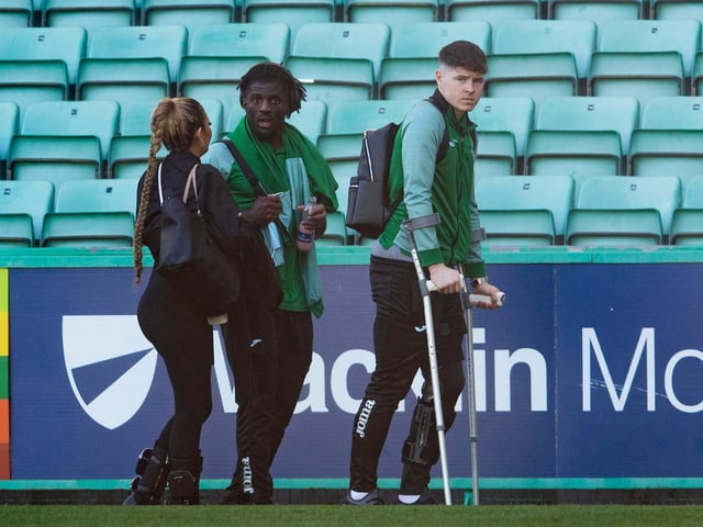There are fears Hibs star Kevin Nisbet could be ruled out for the remainder of the season. The striker was replaced during the first-half of the draw with Celtic on Sunday with a knee injury. He underwent a scan on Monday with results still to be provided but manager Shaun Maloney admitted it didn’t “look promising”. (Scottish Sun)