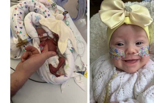 Little Hope Fernie spent more than four months in neonatal care after arriving at just 22 weeks gestation (Pics: Contributed)