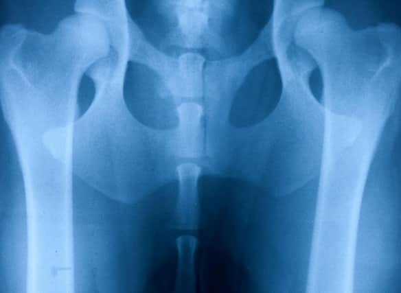 Is your beloved pup at risk of developing hip dysplasia?