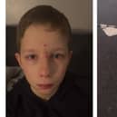 Ten-year-old Jaiden Easton of Methil has two black eyes, a bloodied face, and a potentially broken nose to show for his run in with a damaged speed bump on  Lime Grove (Pics: Submitted)