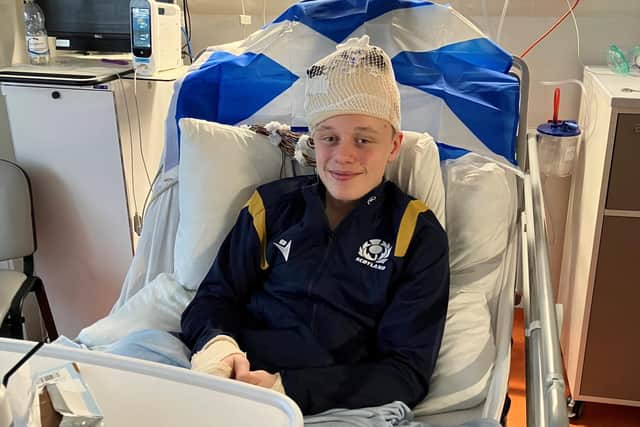 Angus pictured after his surgery at Edinburgh’s Royal Hospital for Children and Young People (Pic: Submitted)