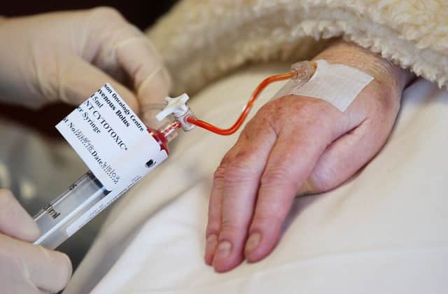 The test can predict which patients would benefit from chemotherapy