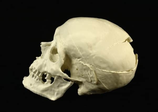 Solomon's skull.